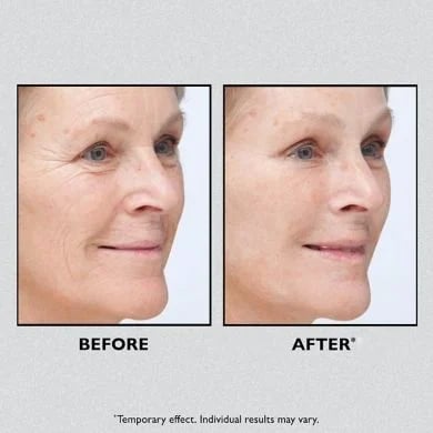 Today 49% OFF Temporary Face Tightener