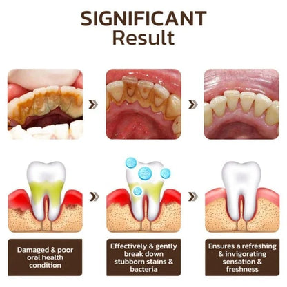 🔥Flash sale🔥SP-6 Toothpaste Oral Health Management, Fresh Breath